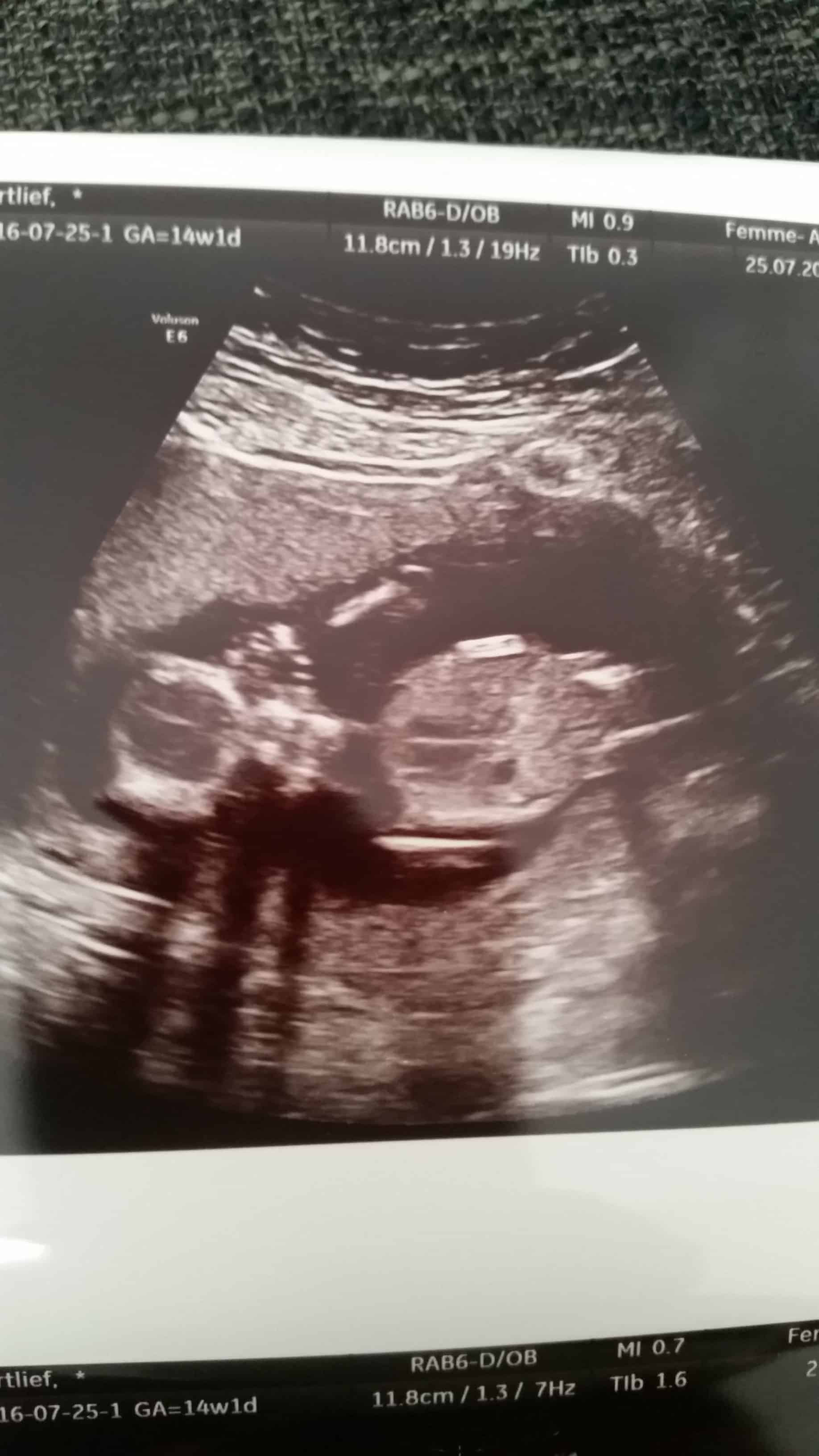 9-16-zwanger-baby-jongen-buik-bijwerkingen-symptomen-zwangerschap-4-maanden-16-weken-buik-gevoel-hormonen-voelen-baby-schopjes-gezicht-echo